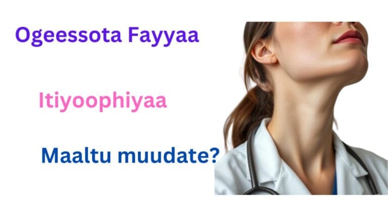 Ogeeyyota fayya biyya dhiisanii bahan/ Ethiopian health care professional who left the country